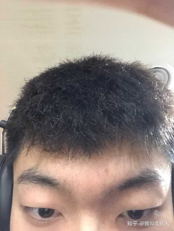 拥有吊眼是怎样的体验?