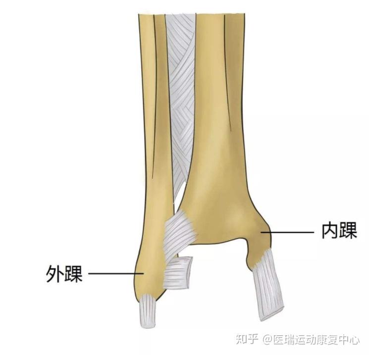 也就是人们常说的"崴脚",其实大多数是指踝关节跖屈 内翻着地(虽然