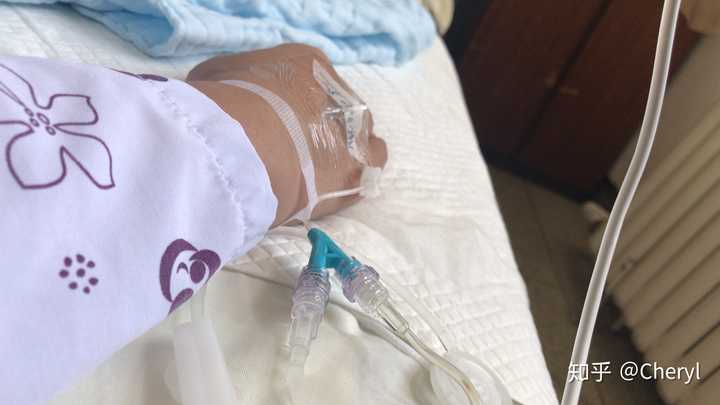 剖腹产到底是什么体验