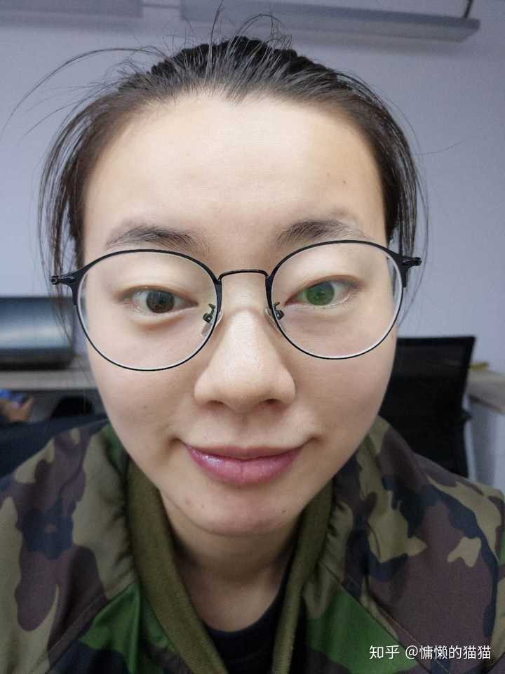 近视眼如何恢复视力摘掉眼镜