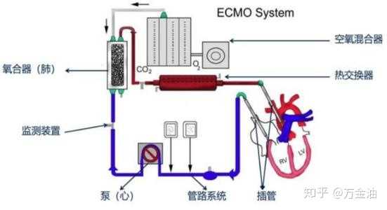 新冠肺炎疫情关键时刻能救命的ecmo,为何全国只有400台且治疗费用这么