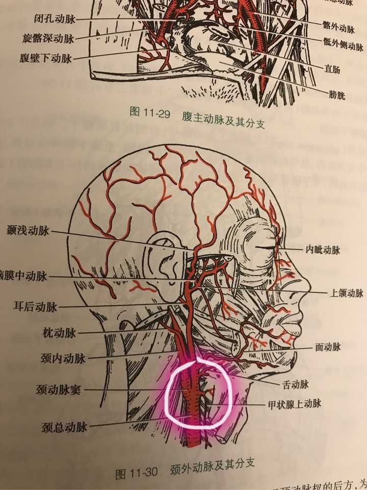 如图 人颈部的颈总动脉末端和颈内动脉起始有一个膨大,叫 颈动脉窦