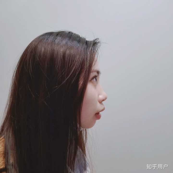 一张侧面实拍,嘴突也是挺严重的害,下巴那叫一个短又缩,这篇我绝对要
