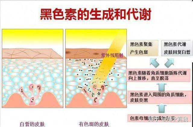 色斑的形成,实际上就是因为体内对于黑色素的新陈代谢,出现了病理性的