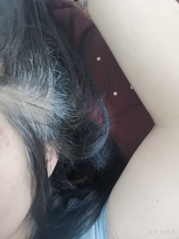 年纪轻轻的女孩子有白头发怎么办?