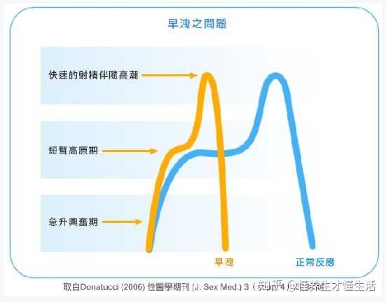 怎么练习pc肌?