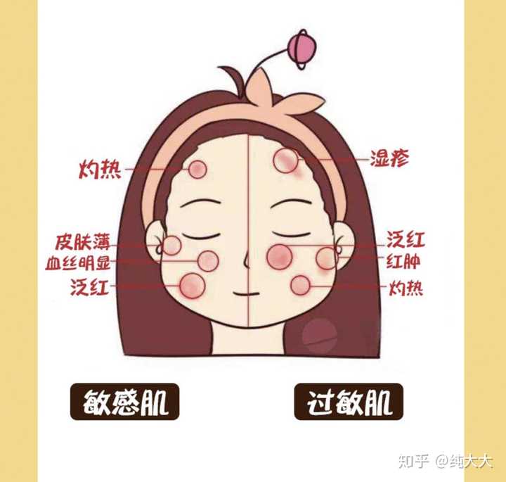 敏感肌怎么来的?这种肤质要怎么护肤?