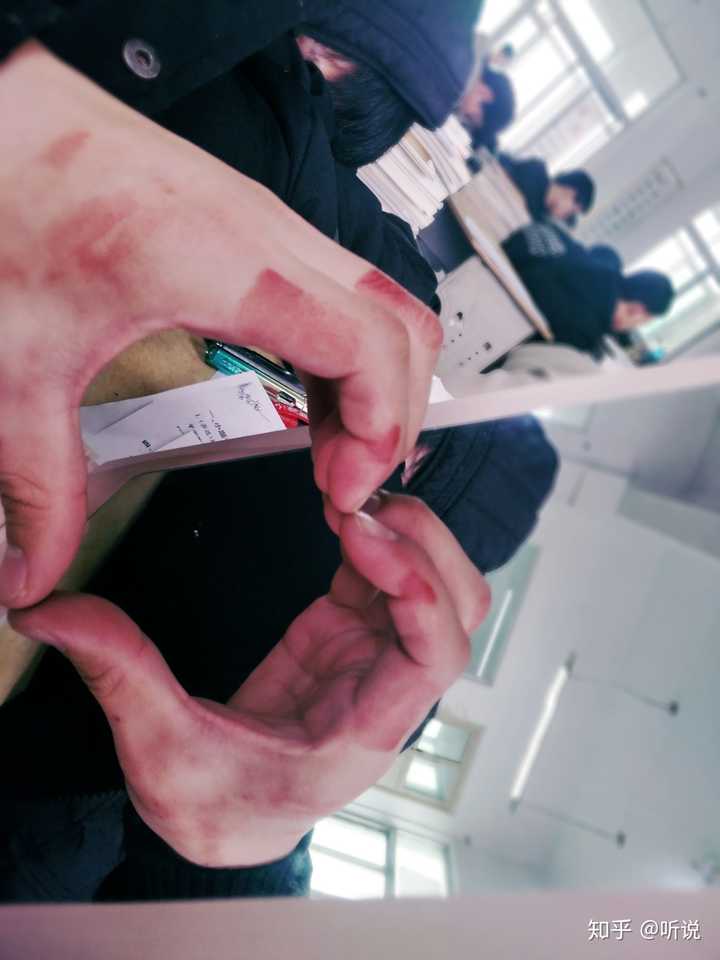 为什么有些人对自残的人恶语相向?