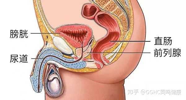 前列腺炎是以尿道刺激症状和慢性盆腔疼痛为主要临床表现的前列腺疾病