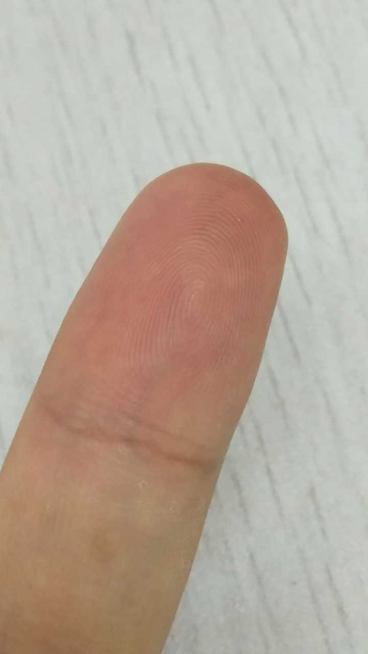 左手无名指