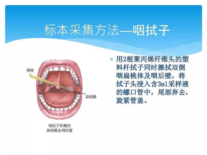 武汉大学中南医院张笑春教授呼吁用ct取代核酸检测不能轻易居家隔离有