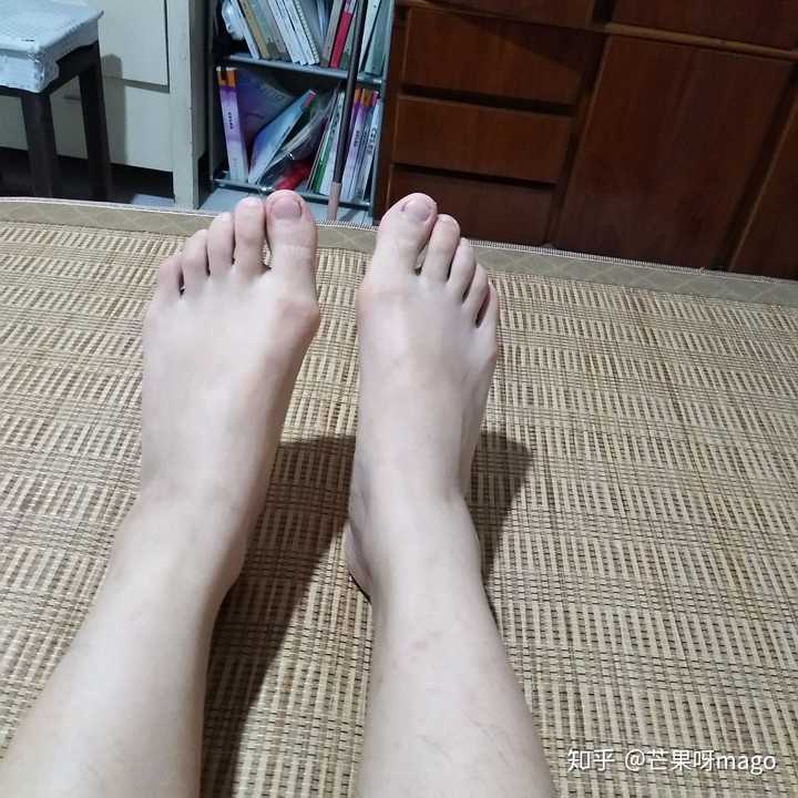 女生脚丑是种什么样的体验?