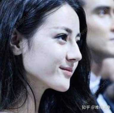下颌角这样是不是只能削了