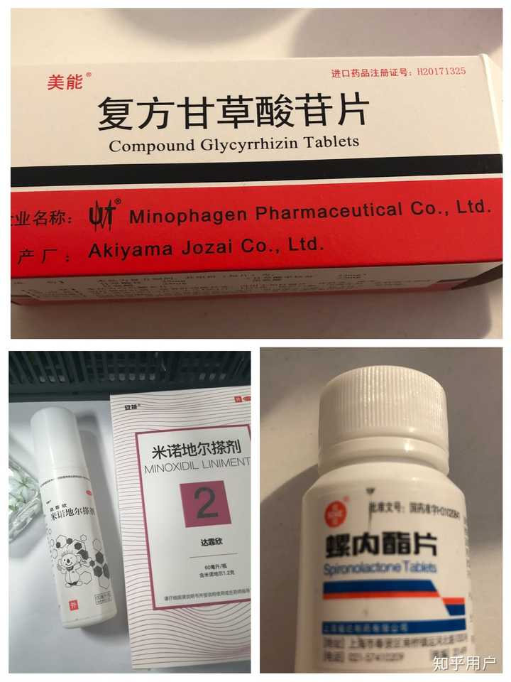 如何避免掉发脱发或者减少脱发?
