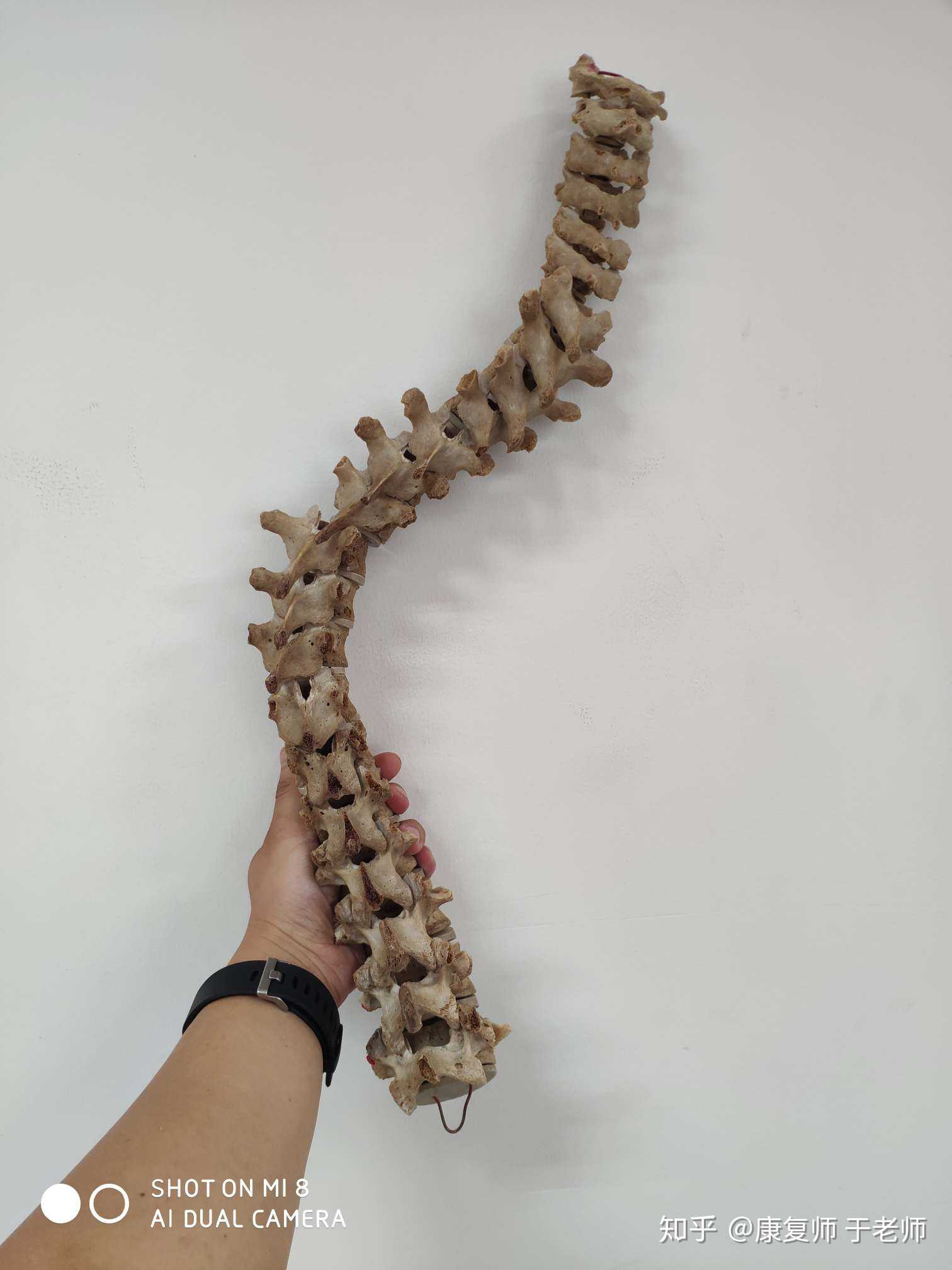 这个可是个真人的骨头!