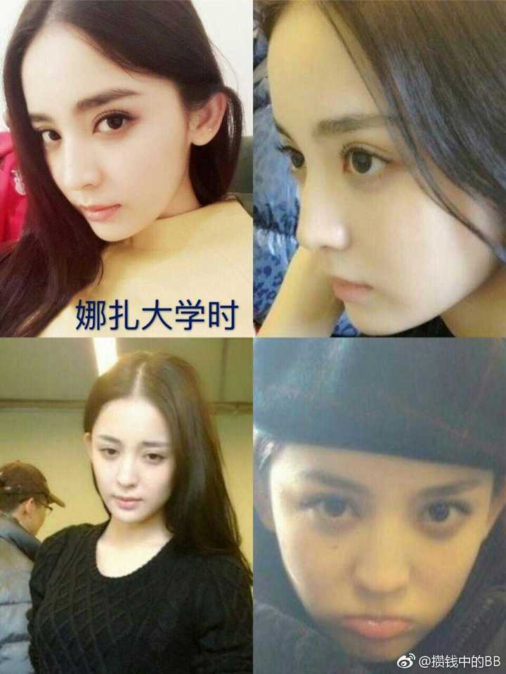 为什么古力娜扎要整容?