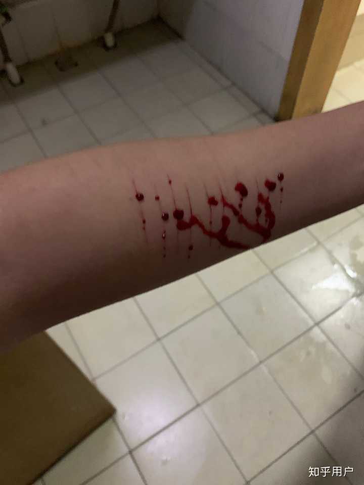 抑郁症患者可能自愈吗?