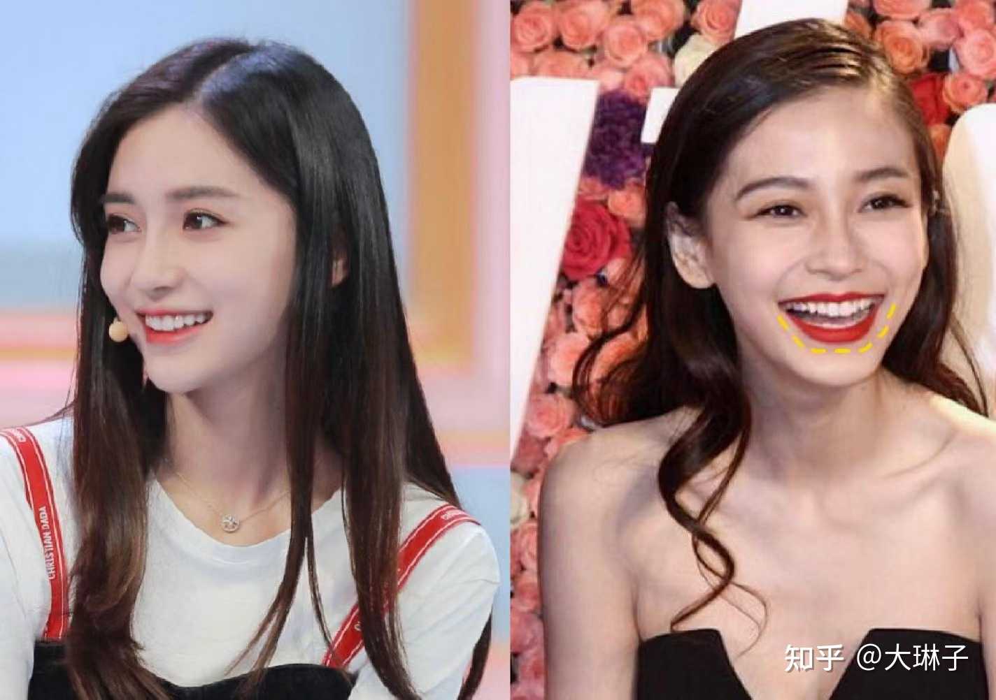笑起来不好看和微笑弧也有一定关系