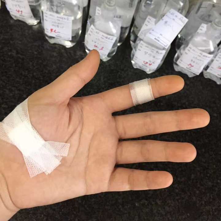 一个晚上掰安瓿瓶被割的口子……真的痛