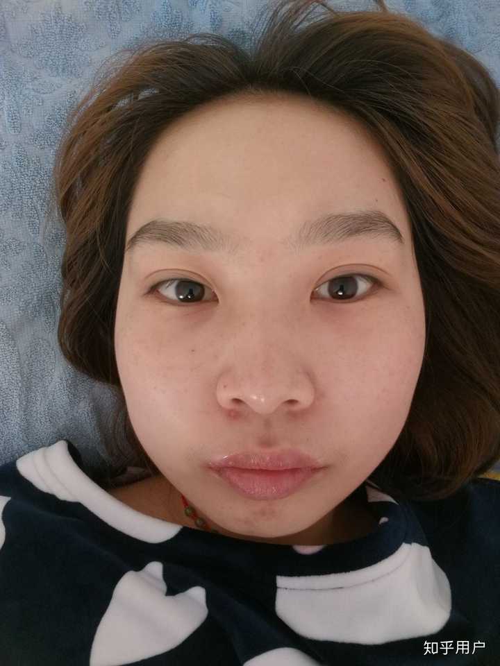偏颌脸歪要怎么整?