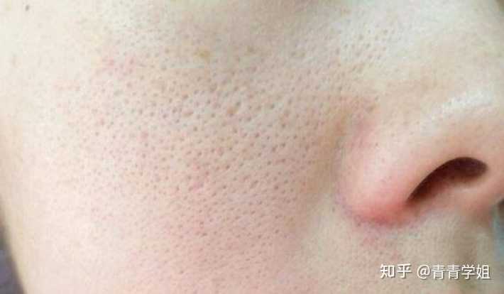控制好你的手,细腻的皮肤经不起暴力折磨,只会产生更严重的后果. 3.