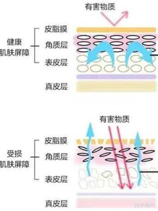 怎么判断皮肤屏障受损受损后怎么修复