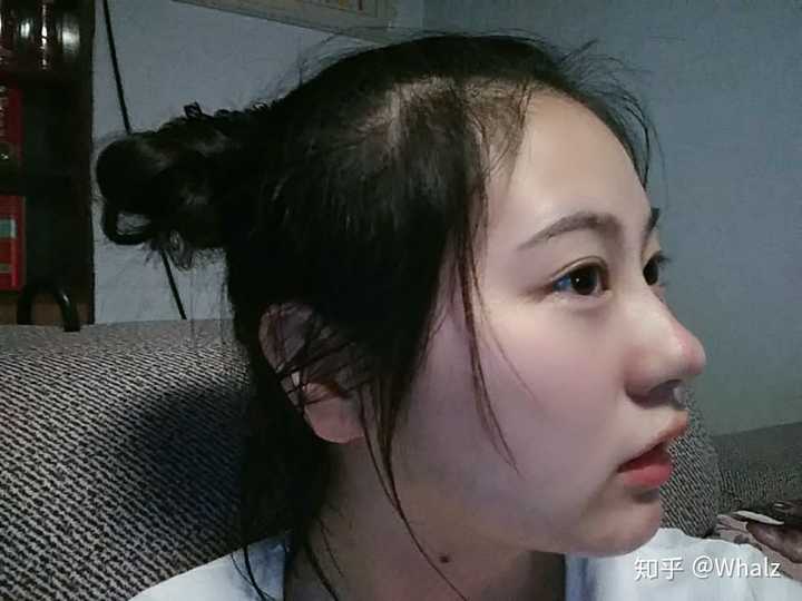 为什么有的女生侧脸比较好看但正脸一般?