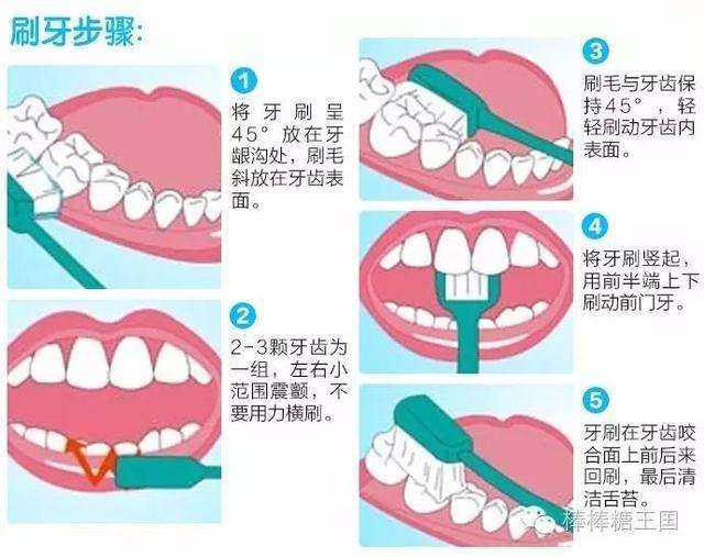 如何正确地刷牙?