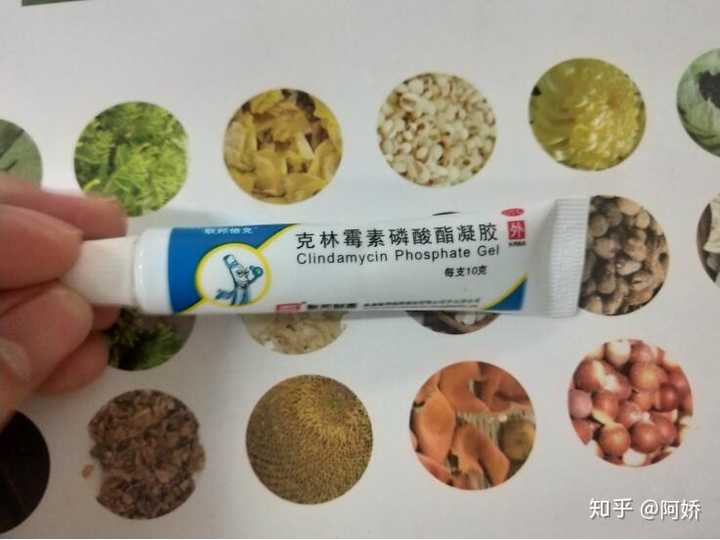 克林霉素磷酸酯凝胶——毛囊炎