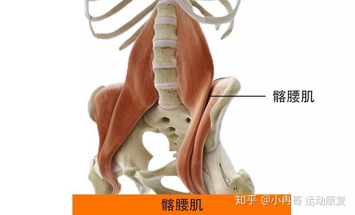 第二,髂腰肌无力