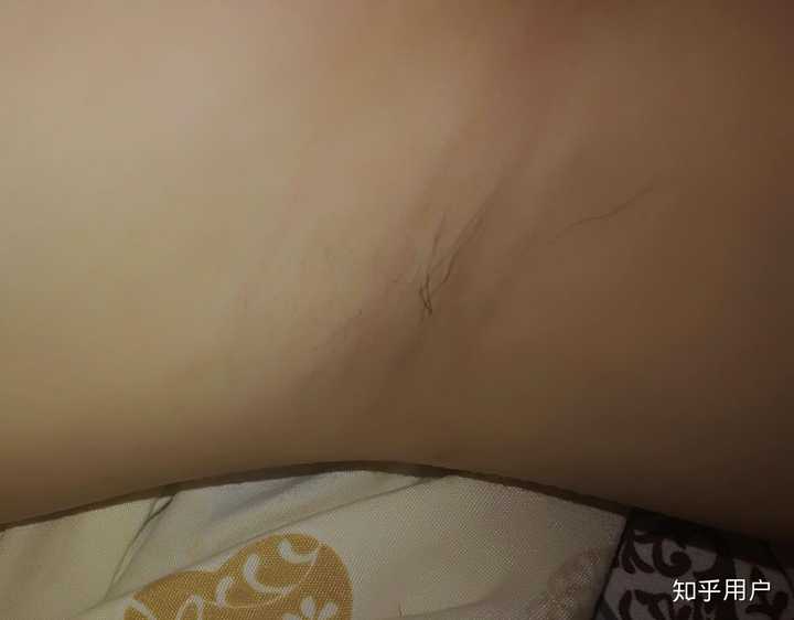 女生脱腋毛最好的方法有哪些?