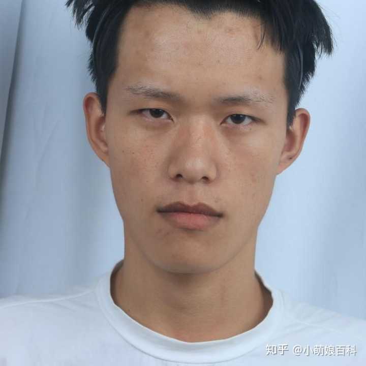 你会支持一个眼睛小的男生割双眼皮么?