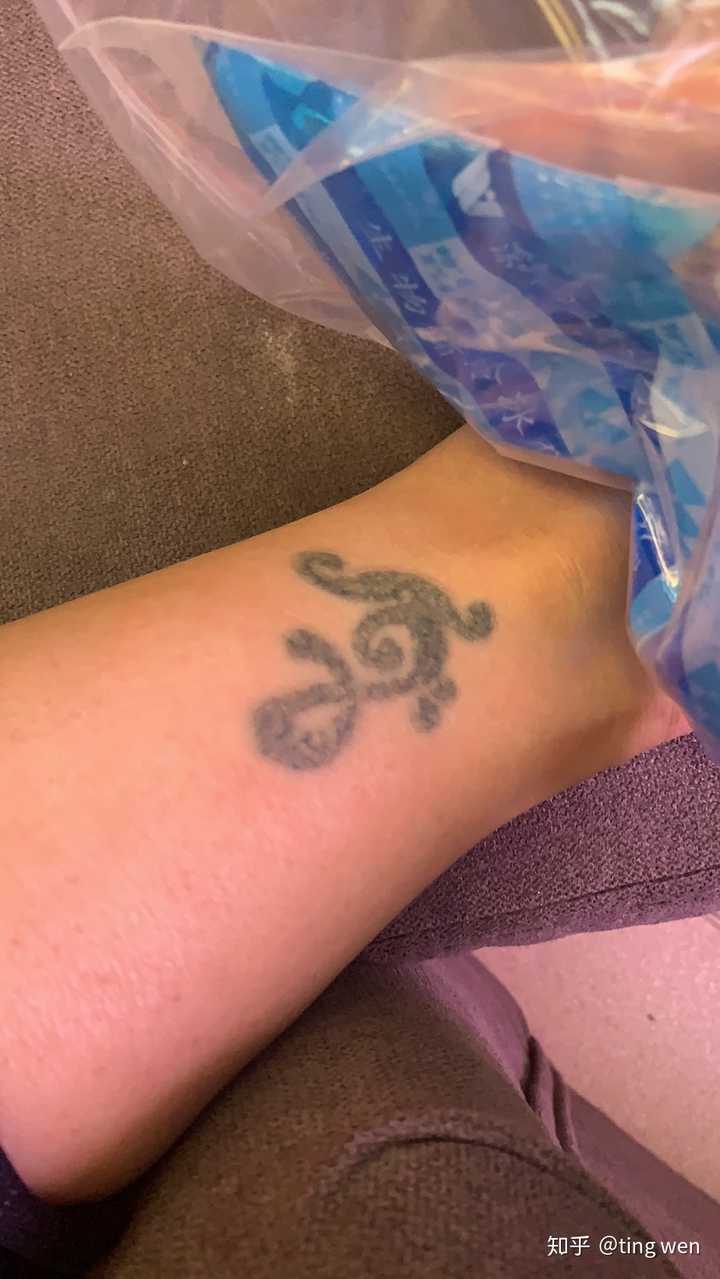 洗纹身的过程是怎么样的?