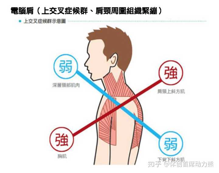 这种有圆肩和骨盆前倾的身材该怎么练有图求指导