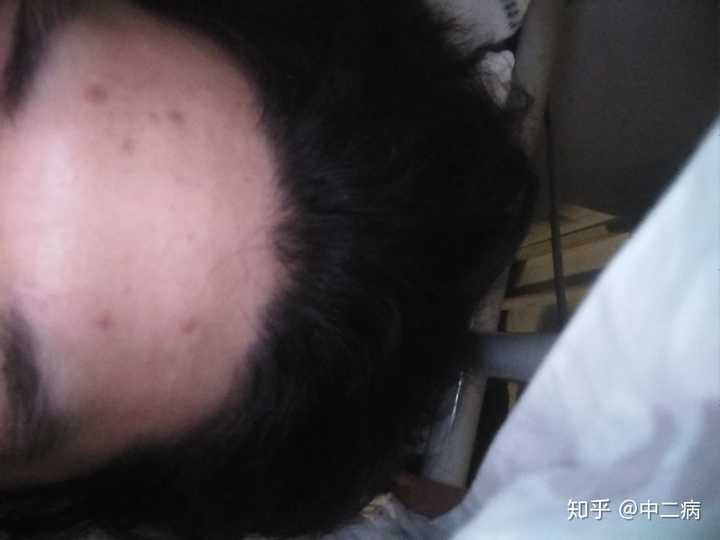 烟瘾很大的人,完全戒烟后是什么感觉?