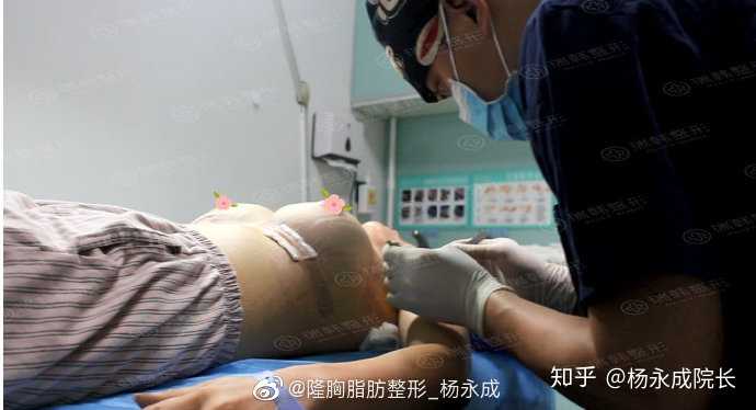 有谁用过微信林灏丰胸的产品,可信吗?