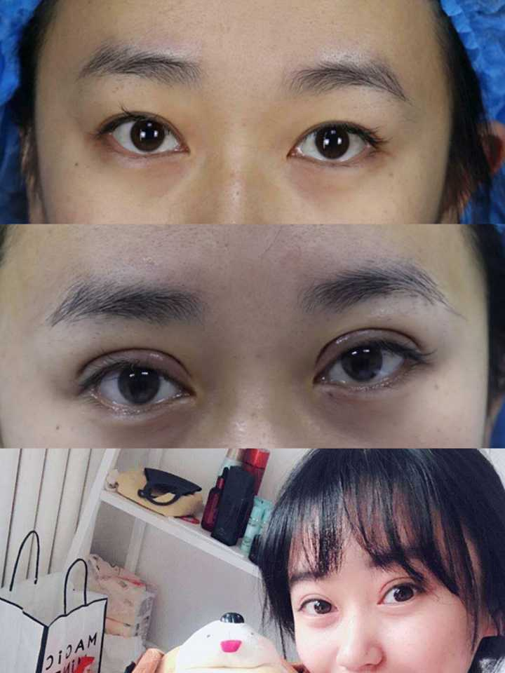 南阳哪家双眼皮做的好,自然一点的?