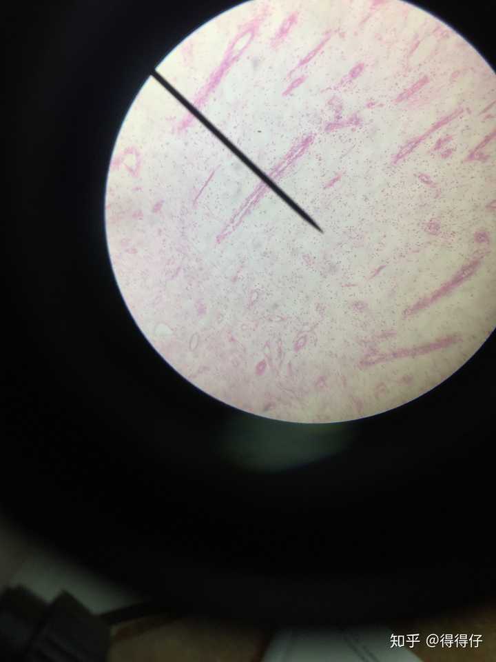 显微镜观察肉芽组织,怎么才能更好的找到血管?