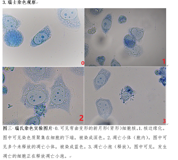 giemsa染色后怎么样的算是凋亡细胞?