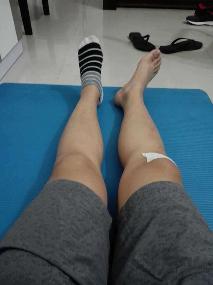 平躺时为什么右腿外旋角度比左腿大