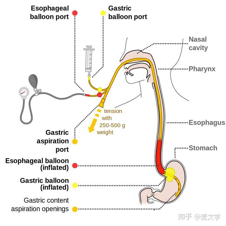 三腔二囊管为什么要从鼻腔而不是口腔插入?