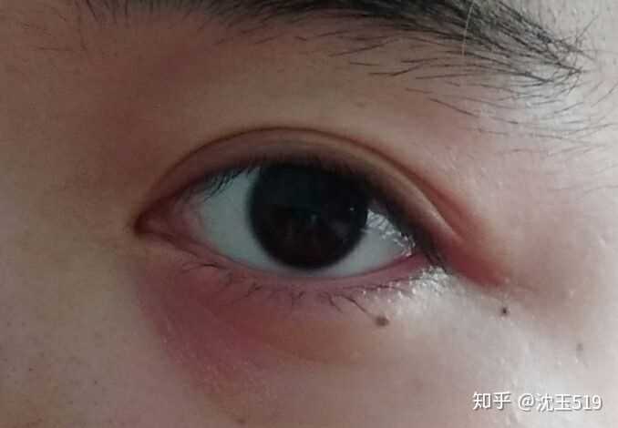 请问我左眼尾的痣是桃花痣吗?有什么含义?这颗痣好不好?