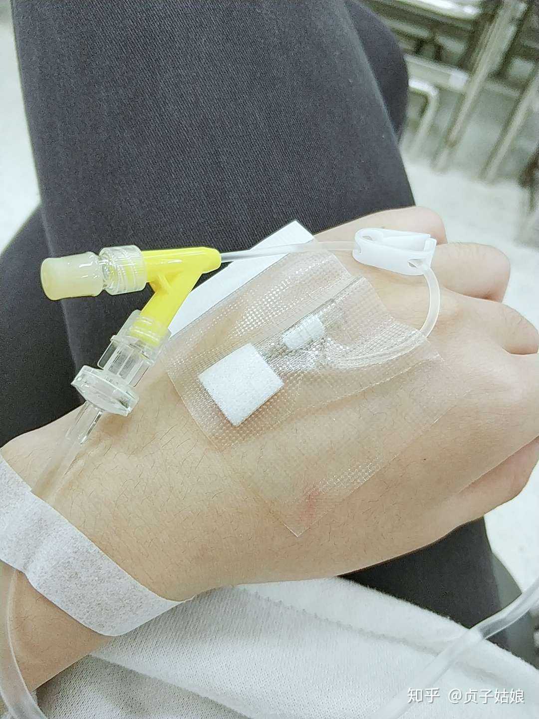 挂水是真的累