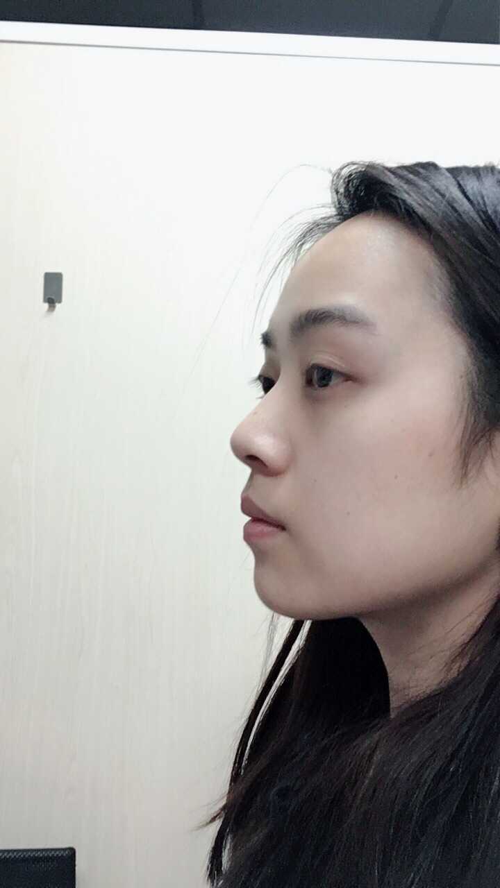 正脸长得很惊艳(帅)而侧脸长得很挫是怎么样一种体验?