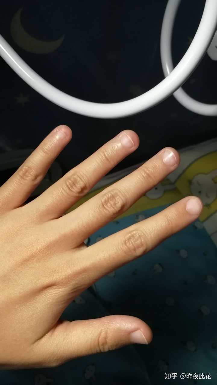 从小指甲就很软,长长了就会往上翘所以总是忍不住想咬掉,哭了.