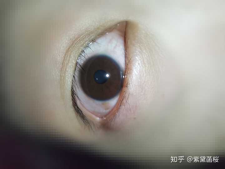 得了抑郁症的人眼神是不是都是一样的?