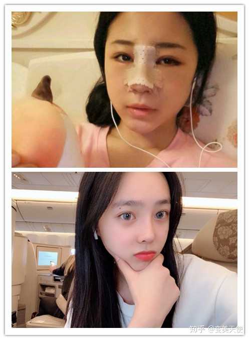 在温州做整形哪家做的比较好?