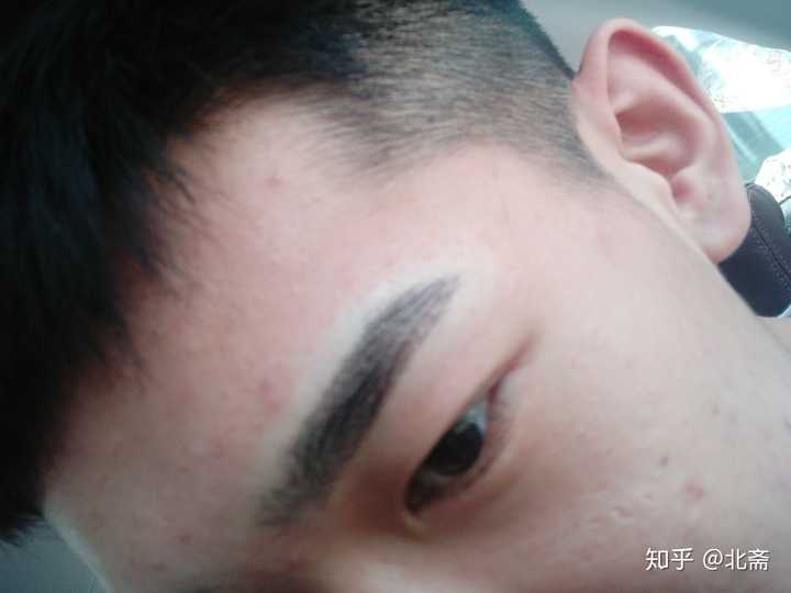 男生纹眉后变得有点自卑,我该怎么办?