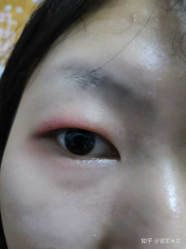 首先用双眼皮贴撑出双眼皮,如果撑不住可以用一个假睫毛,一般只要撑出