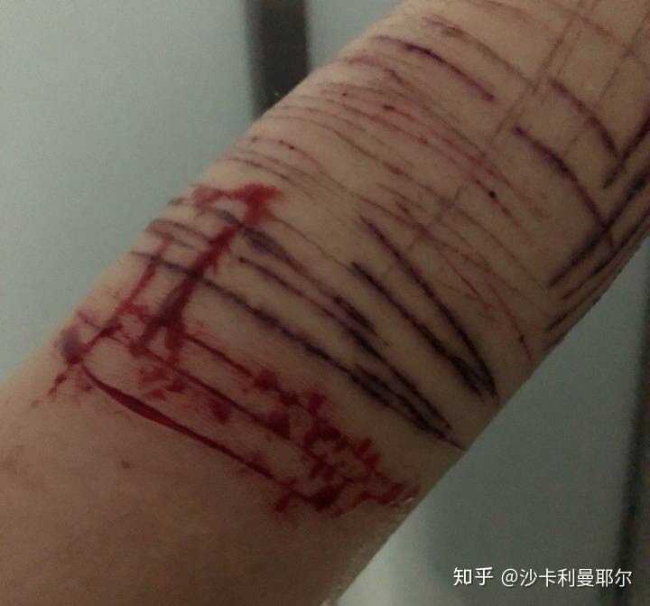 父母知道自己孩子自残会怎么样?